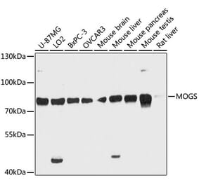Western Blot - Anti-GCS1 Antibody (A91278) - Antibodies.com