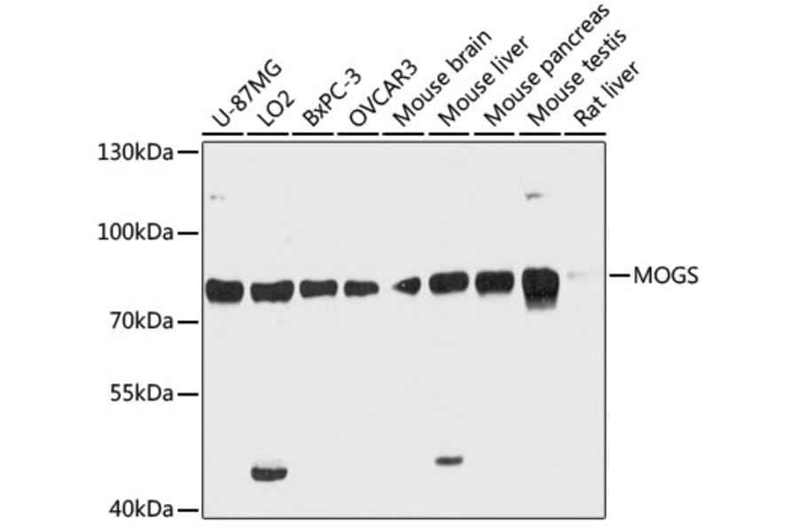 Western Blot - Anti-GCS1 Antibody (A91278) - Antibodies.com