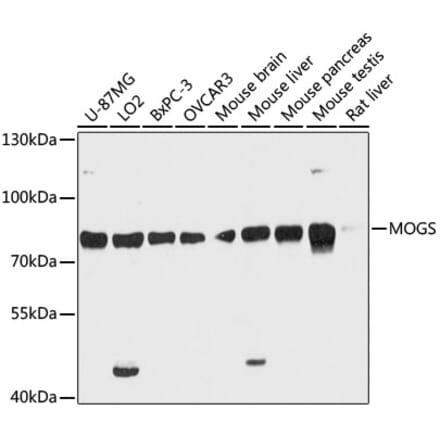 Western Blot - Anti-GCS1 Antibody (A91278) - Antibodies.com