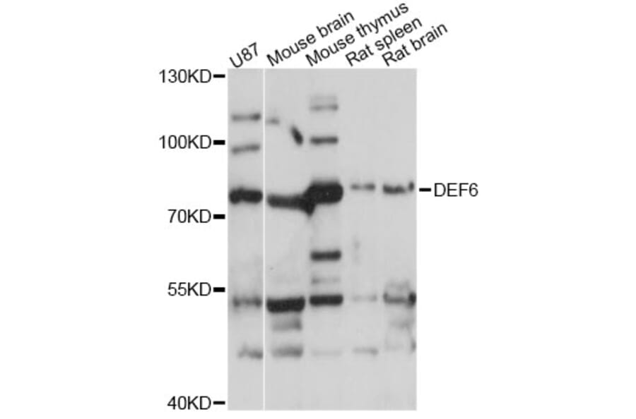 Western Blot - Anti-DEF6 Antibody (A14337) - Antibodies.com