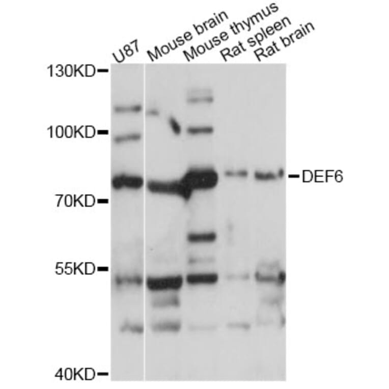Western Blot - Anti-DEF6 Antibody (A14337) - Antibodies.com