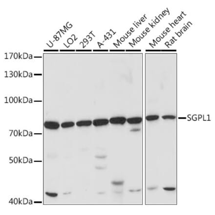 Western Blot - Anti-SGPL1 Antibody (A91280) - Antibodies.com