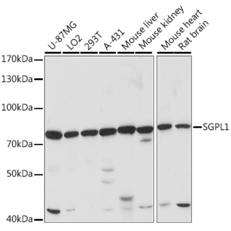 Western Blot - Anti-SGPL1 Antibody (A91280) - Antibodies.com