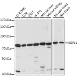 Western Blot - Anti-SGPL1 Antibody (A91280) - Antibodies.com
