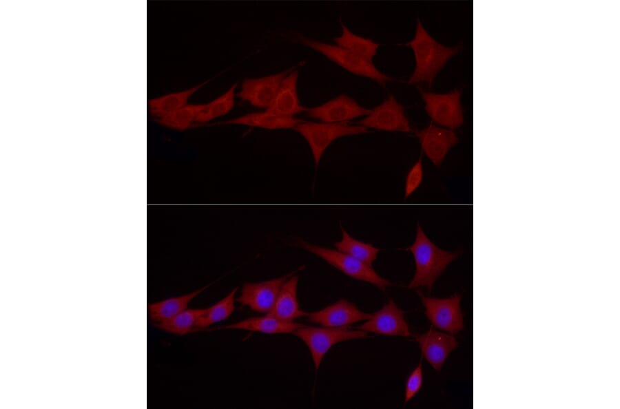 Immunofluorescence - Anti-SGPL1 Antibody (A91280) - Antibodies.com