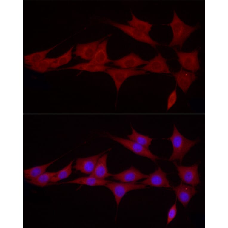 Immunofluorescence - Anti-SGPL1 Antibody (A91280) - Antibodies.com