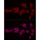 Immunofluorescence - Anti-SGPL1 Antibody (A91280) - Antibodies.com