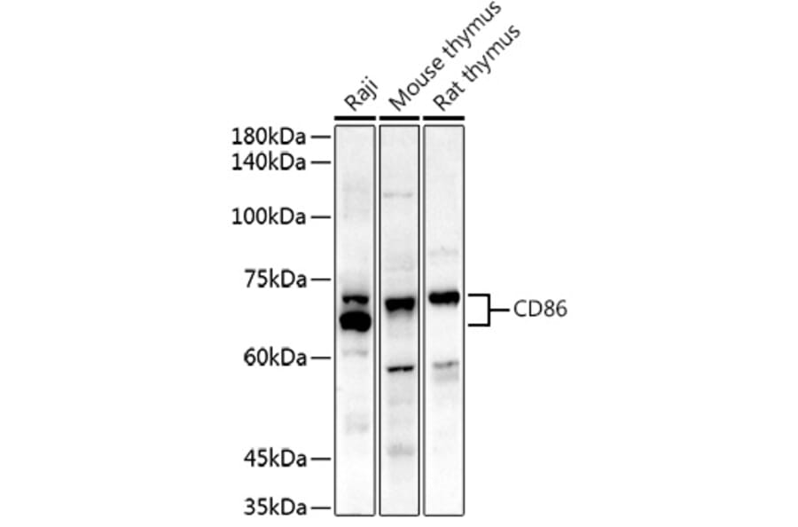Western Blot - Anti-CD86 Antibody (A91282) - Antibodies.com