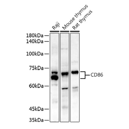 Western Blot - Anti-CD86 Antibody (A91282) - Antibodies.com