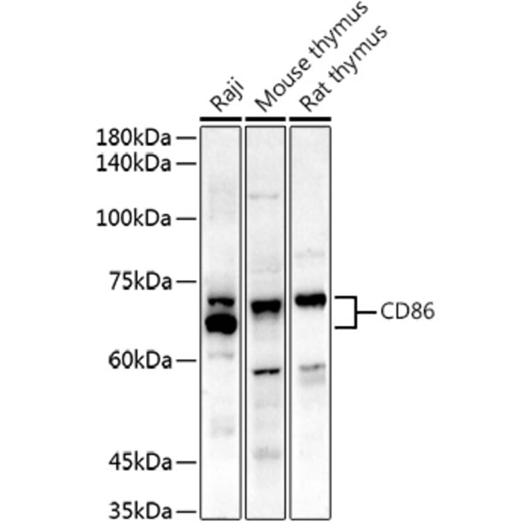 Western Blot - Anti-CD86 Antibody (A91282) - Antibodies.com