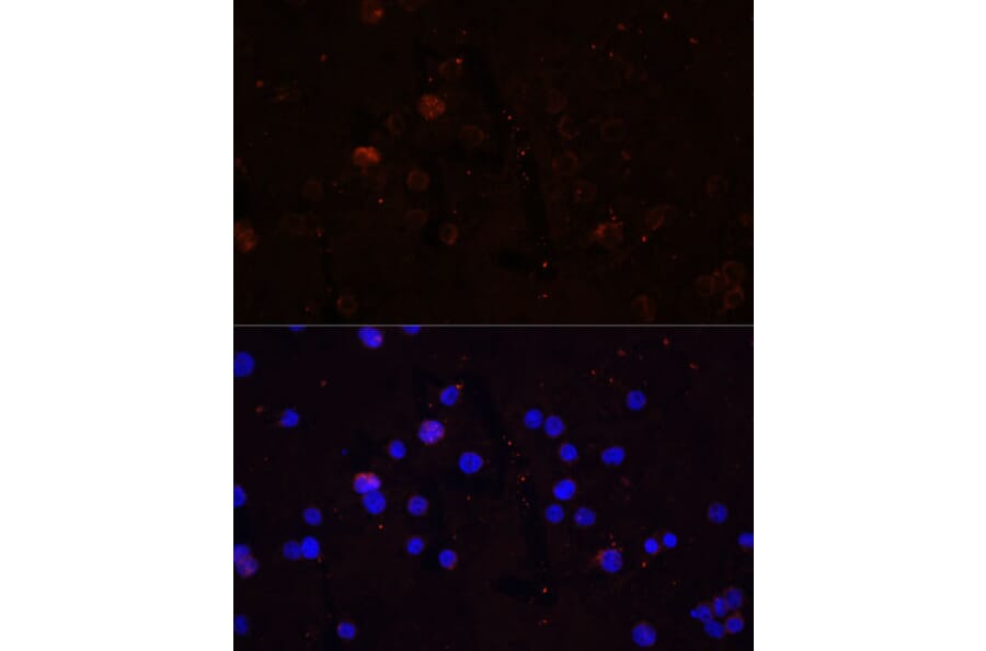Immunofluorescence - Anti-CD86 Antibody (A91282) - Antibodies.com