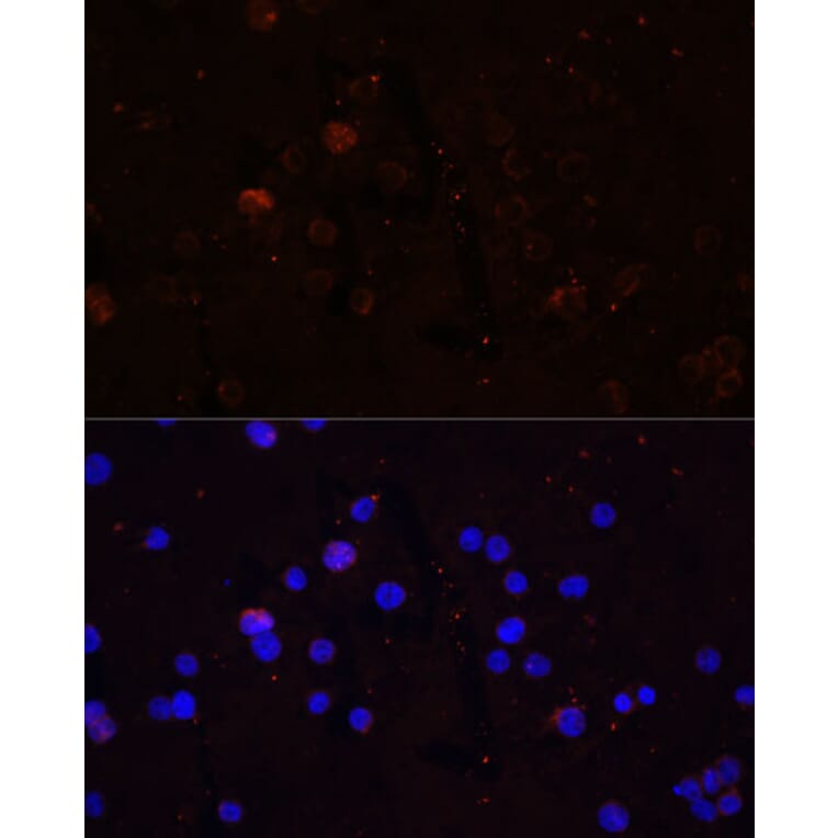 Immunofluorescence - Anti-CD86 Antibody (A91282) - Antibodies.com