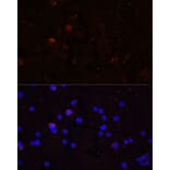 Immunofluorescence - Anti-CD86 Antibody (A91282) - Antibodies.com