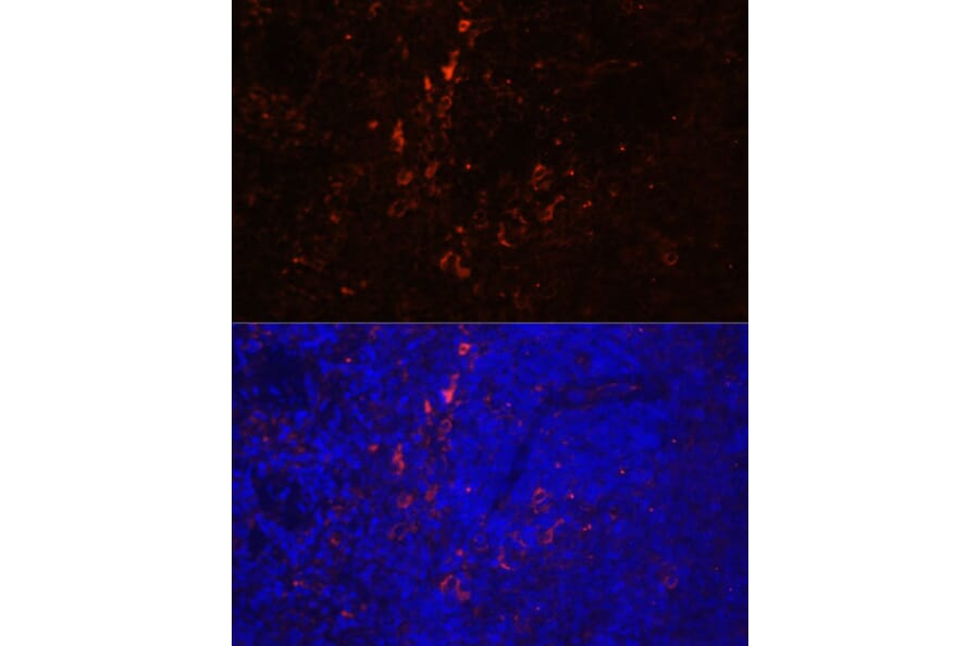 Immunofluorescence - Anti-CD86 Antibody (A91282) - Antibodies.com