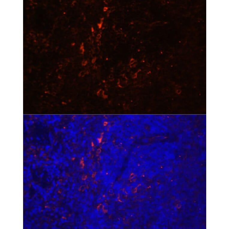 Immunofluorescence - Anti-CD86 Antibody (A91282) - Antibodies.com