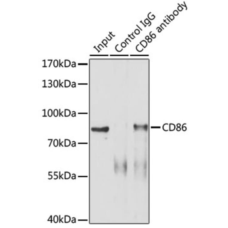 Western Blot - Anti-CD86 Antibody (A91282) - Antibodies.com