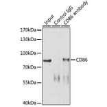 Western Blot - Anti-CD86 Antibody (A91282) - Antibodies.com