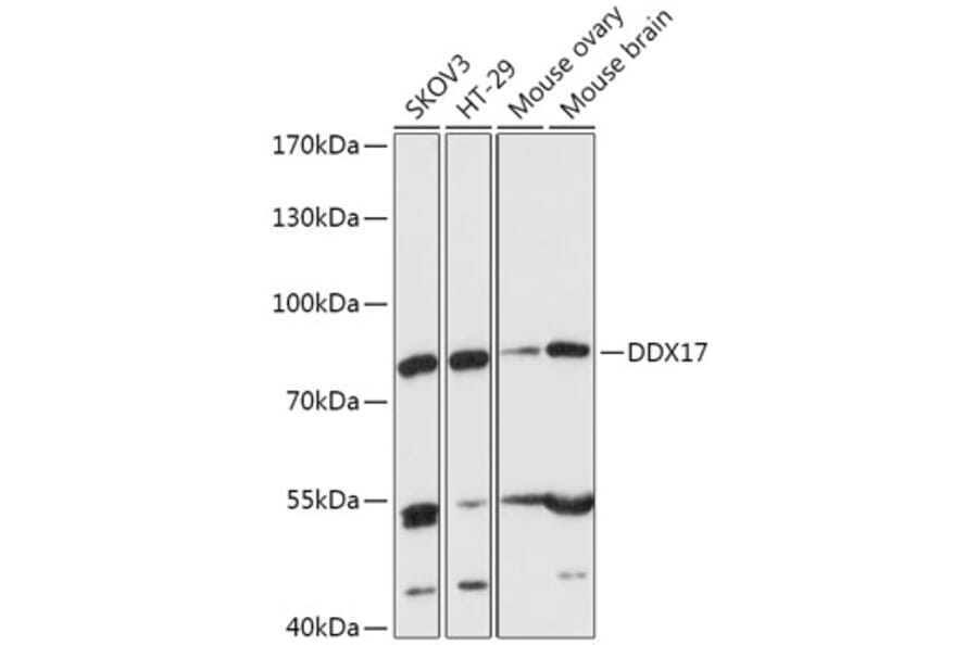 Western Blot - Anti-DDX17 Antibody (A91283) - Antibodies.com