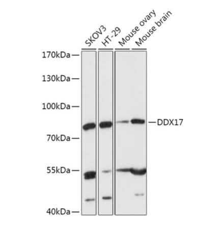 Western Blot - Anti-DDX17 Antibody (A91283) - Antibodies.com