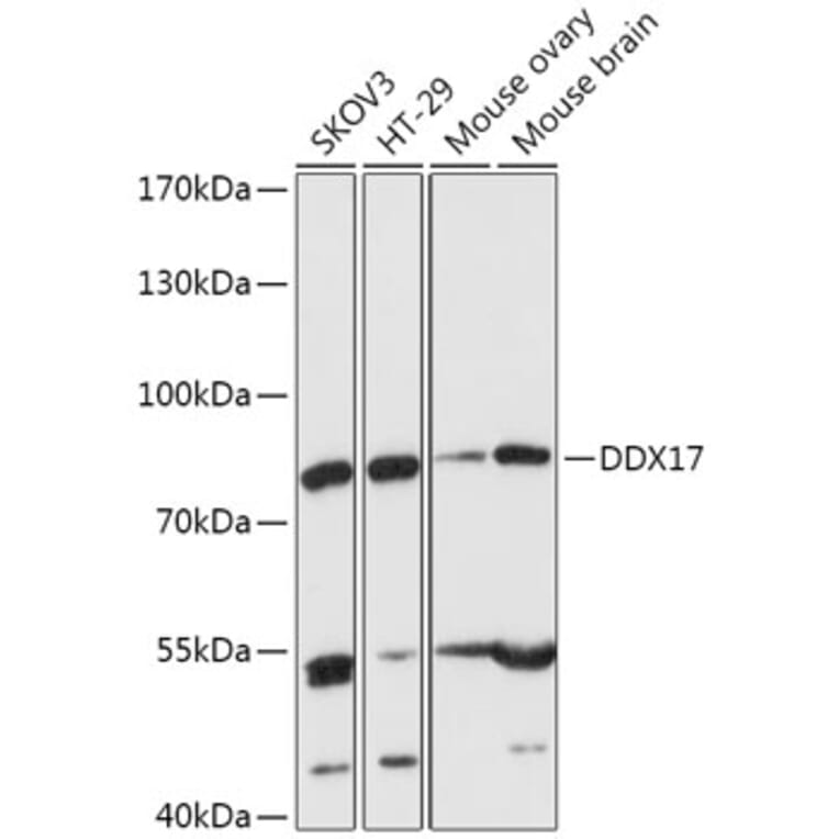 Western Blot - Anti-DDX17 Antibody (A91283) - Antibodies.com