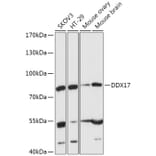 Western Blot - Anti-DDX17 Antibody (A91283) - Antibodies.com