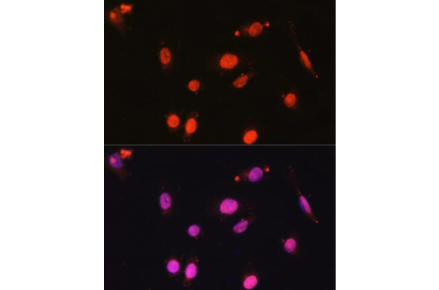 Immunofluorescence - Anti-DDX17 Antibody (A91283) - Antibodies.com
