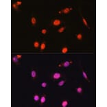 Immunofluorescence - Anti-DDX17 Antibody (A91283) - Antibodies.com