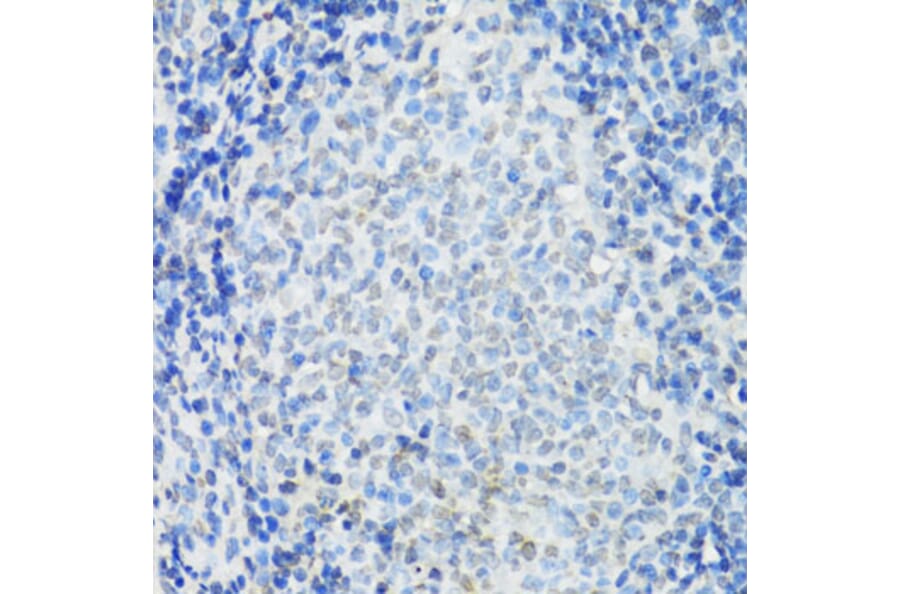 Immunohistochemistry - Anti-IKKi/IKKe Antibody (A91284) - Antibodies.com
