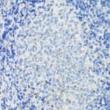 Immunohistochemistry - Anti-IKKi/IKKe Antibody (A91284) - Antibodies.com
