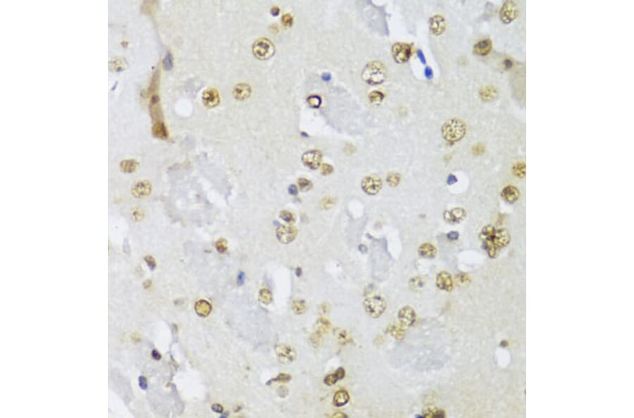 Immunohistochemistry - Anti-IKKi/IKKe Antibody (A91284) - Antibodies.com