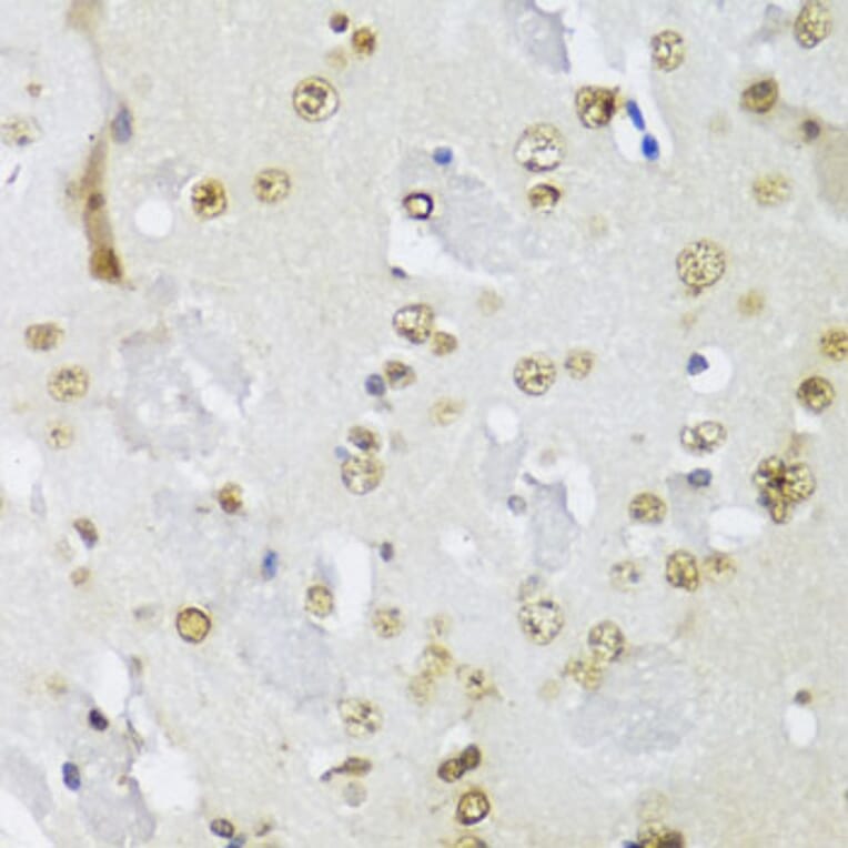 Immunohistochemistry - Anti-IKKi/IKKe Antibody (A91284) - Antibodies.com
