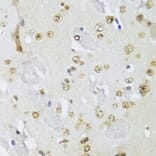 Immunohistochemistry - Anti-IKKi/IKKe Antibody (A91284) - Antibodies.com