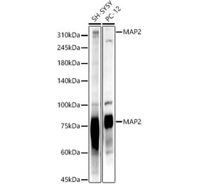 Western Blot - Anti-MAP2 Antibody (A91285) - Antibodies.com