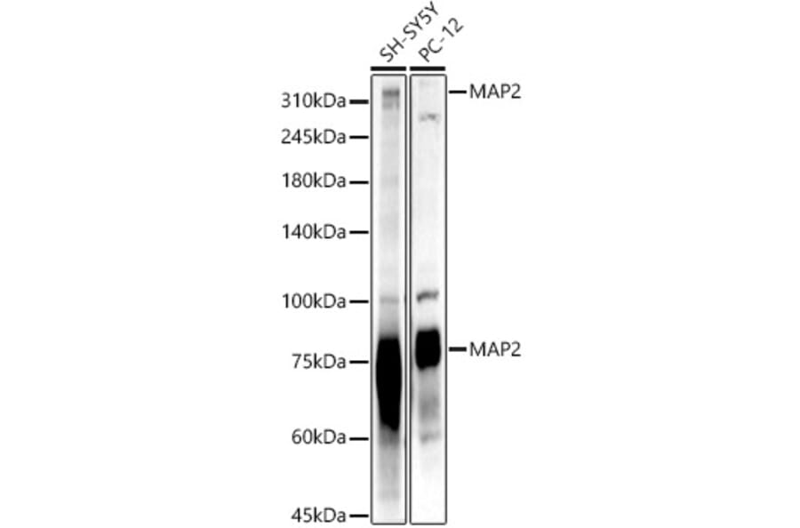 Western Blot - Anti-MAP2 Antibody (A91285) - Antibodies.com