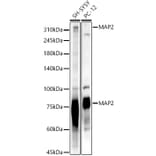 Western Blot - Anti-MAP2 Antibody (A91285) - Antibodies.com