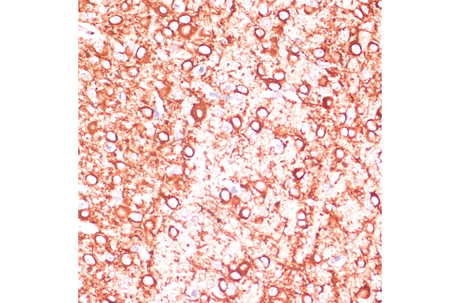 Immunohistochemistry - Anti-MAP2 Antibody (A91285) - Antibodies.com