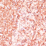 Immunohistochemistry - Anti-MAP2 Antibody (A91285) - Antibodies.com