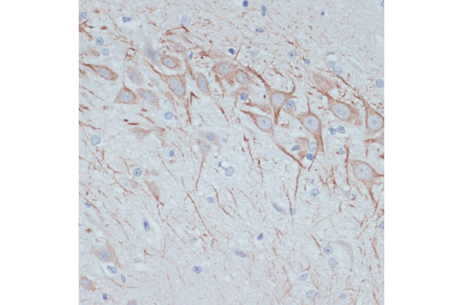 Immunohistochemistry - Anti-MAP2 Antibody (A91285) - Antibodies.com