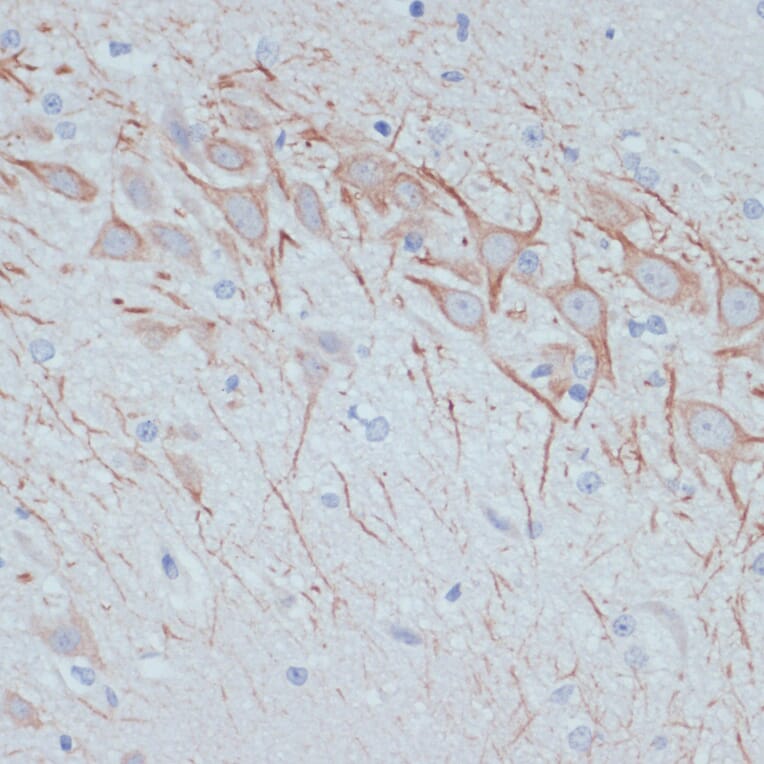 Immunohistochemistry - Anti-MAP2 Antibody (A91285) - Antibodies.com