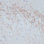 Immunohistochemistry - Anti-MAP2 Antibody (A91285) - Antibodies.com