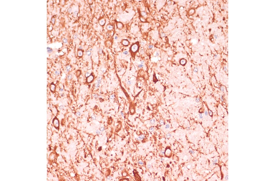 Immunohistochemistry - Anti-MAP2 Antibody (A91285) - Antibodies.com