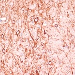 Immunohistochemistry - Anti-MAP2 Antibody (A91285) - Antibodies.com