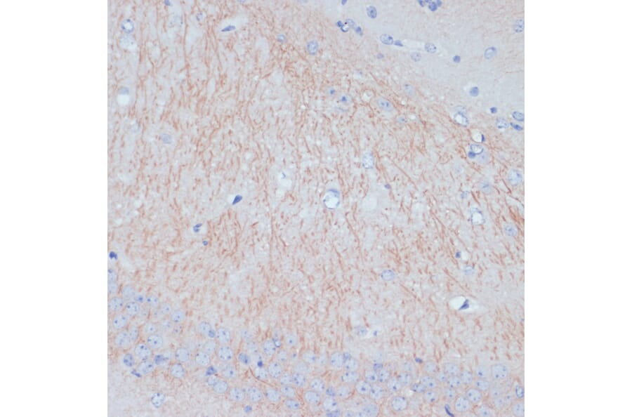 Immunohistochemistry - Anti-MAP2 Antibody (A91285) - Antibodies.com