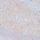 Immunohistochemistry - Anti-MAP2 Antibody (A91285) - Antibodies.com