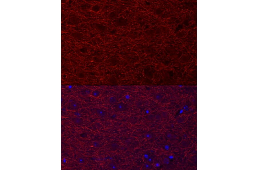 Immunofluorescence - Anti-MAP2 Antibody (A91285) - Antibodies.com