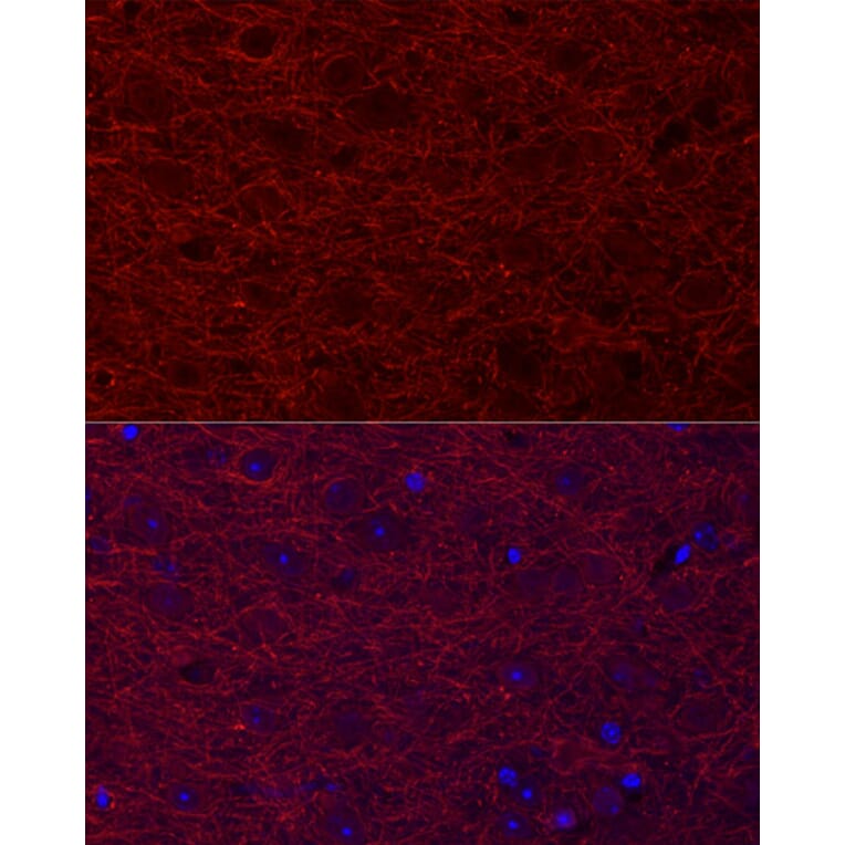 Immunofluorescence - Anti-MAP2 Antibody (A91285) - Antibodies.com