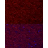 Immunofluorescence - Anti-MAP2 Antibody (A91285) - Antibodies.com