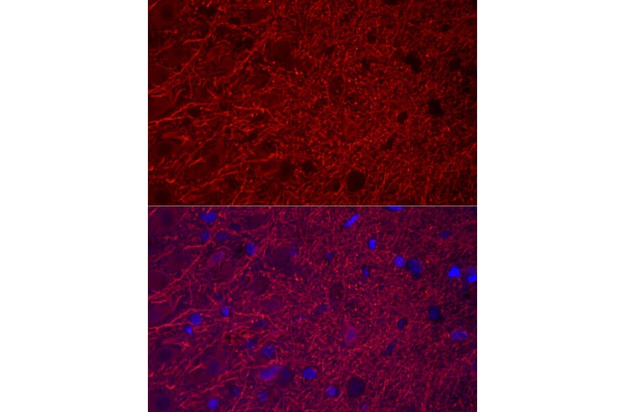 Immunofluorescence - Anti-MAP2 Antibody (A91285) - Antibodies.com