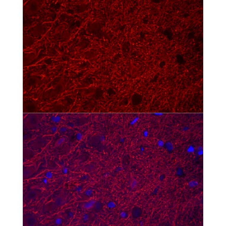 Immunofluorescence - Anti-MAP2 Antibody (A91285) - Antibodies.com