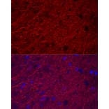 Immunofluorescence - Anti-MAP2 Antibody (A91285) - Antibodies.com